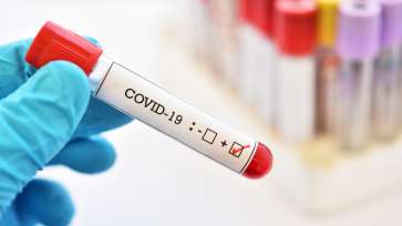 GCS: 19.371 de cazuri noi de COVID; 48 de decese raportate în ultimele 24 de ore